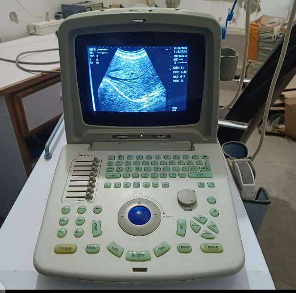 portable ultrasound machine / color doppler for sale 8