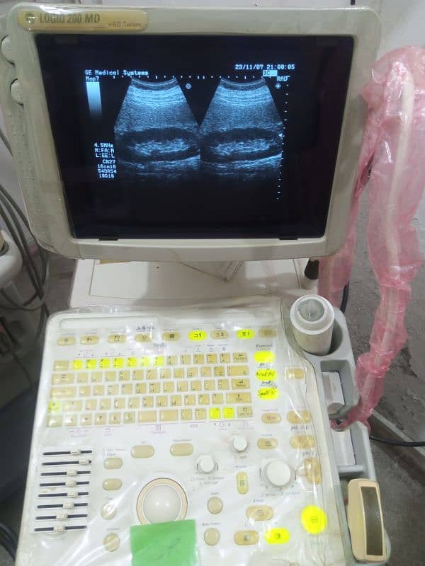 portable ultrasound machine / color doppler for sale 11