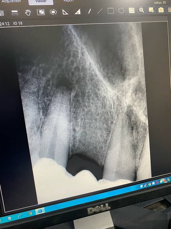 Dental Xray Sourse 1