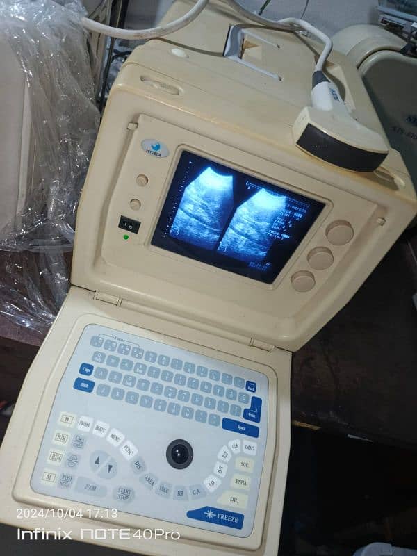 Ultrasound machine 0