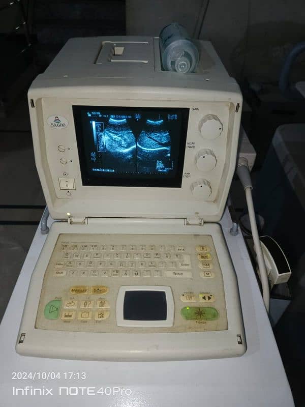 Ultrasound machine 1