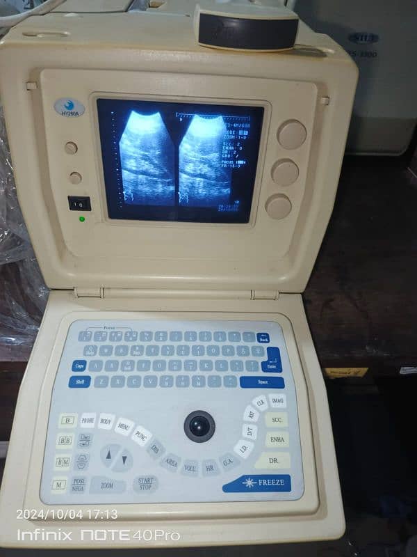 Ultrasound machine 3