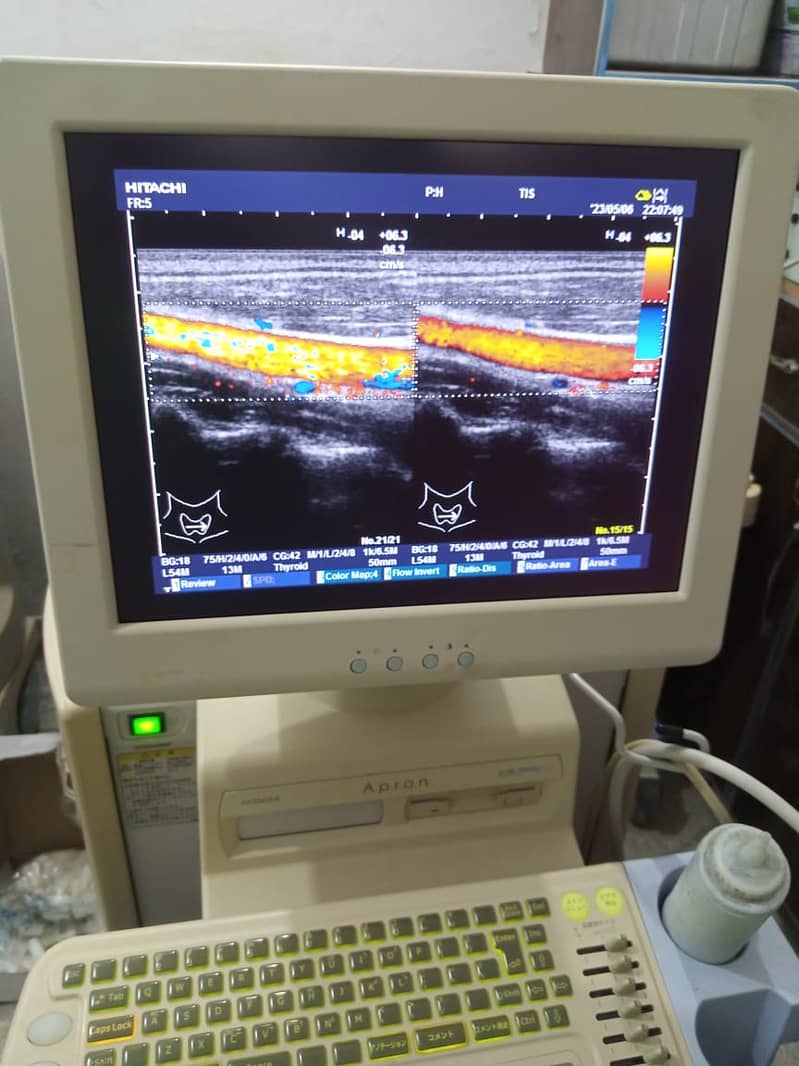 ultrasound machine / portable ultrasound machine / colour daoppler 1