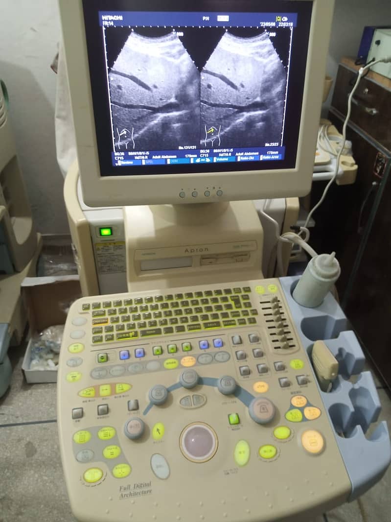 ultrasound machine / portable ultrasound machine / colour daoppler 2