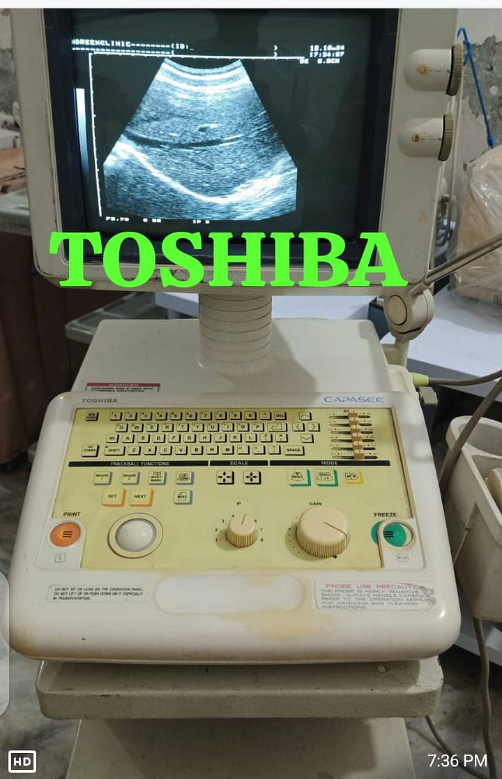 ultrasound machine / portable ultrasound machine / colour daoppler 4