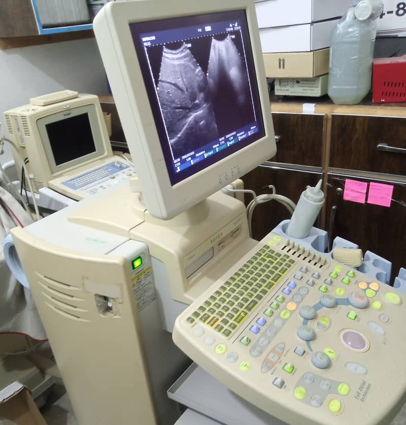 ultrasound machine / portable ultrasound machine / colour daoppler 8