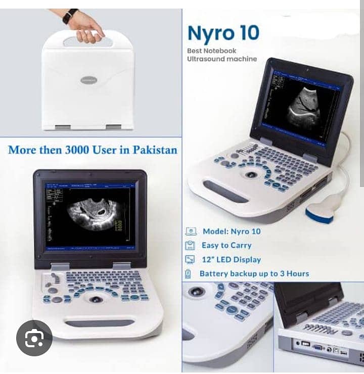 ultrasound machine / portable ultrasound machine / colour daoppler 9