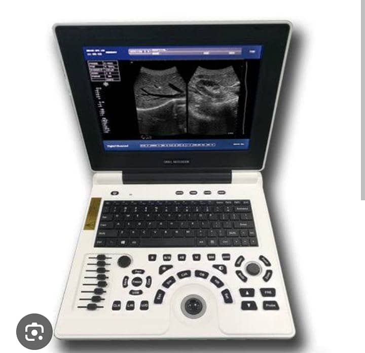 ultrasound machine / portable ultrasound machine / colour daoppler 10