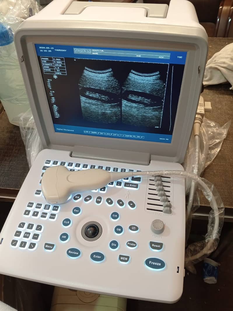 ultrasound machine / portable ultrasound machine / colour daoppler 13