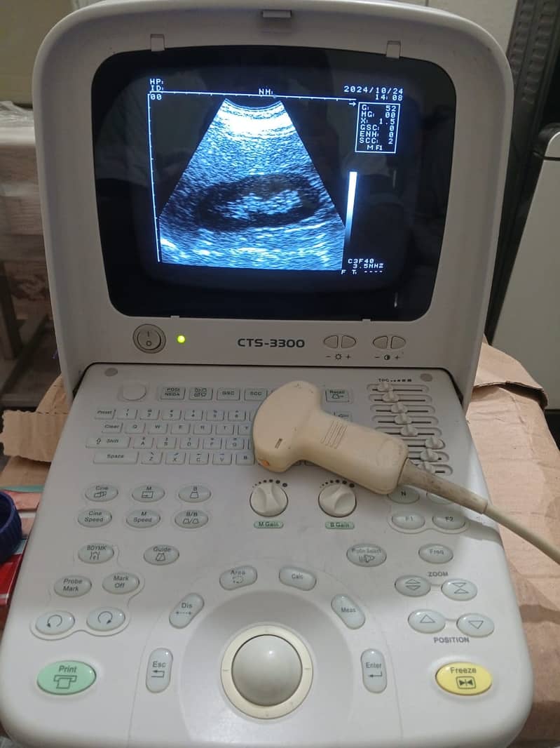 ultrasound machine / portable ultrasound machine / colour daoppler 19