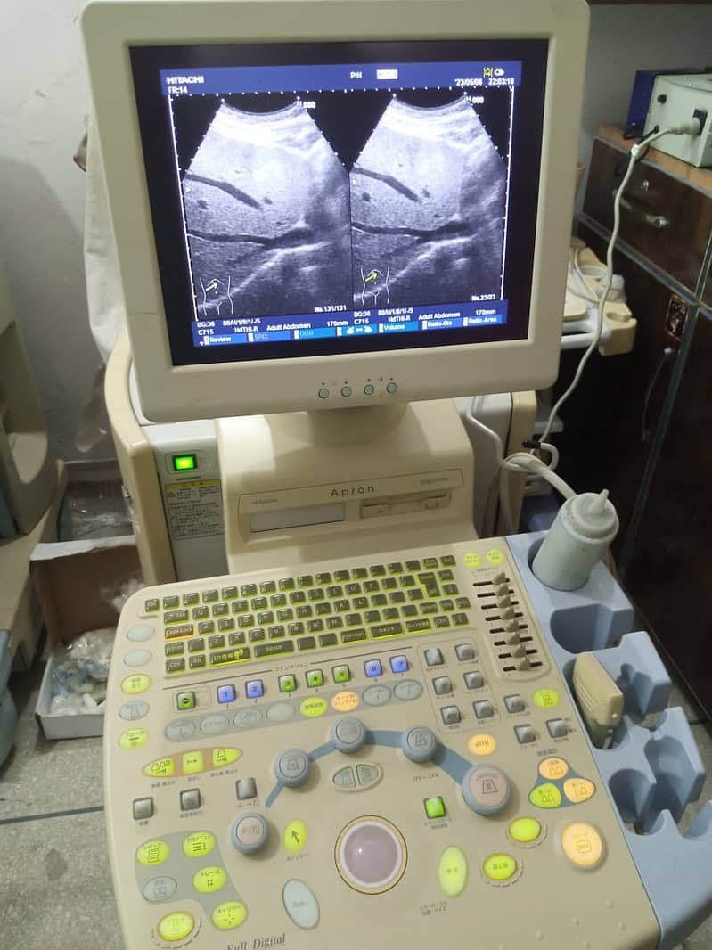 COLOUR DOAPPLER / ULTRASOUND MACHINE / BRAND NEW ULTRASOUND MACHINE 2