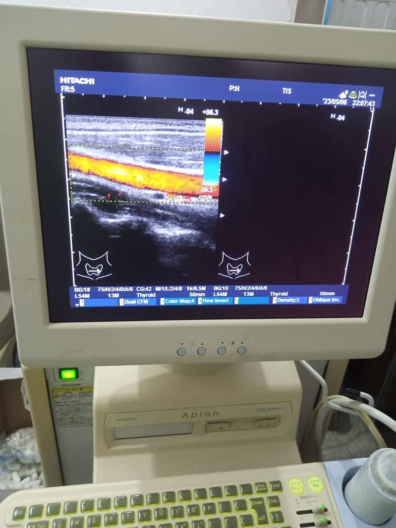 COLOUR DOAPPLER / ULTRASOUND MACHINE / BRAND NEW ULTRASOUND MACHINE 3