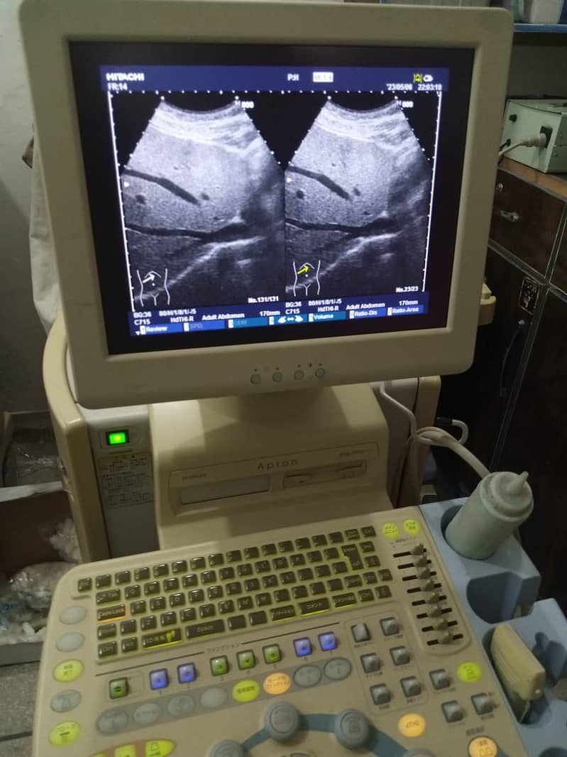 Ultrasound Machine / ultrasound repairing lab / colour doappler 7