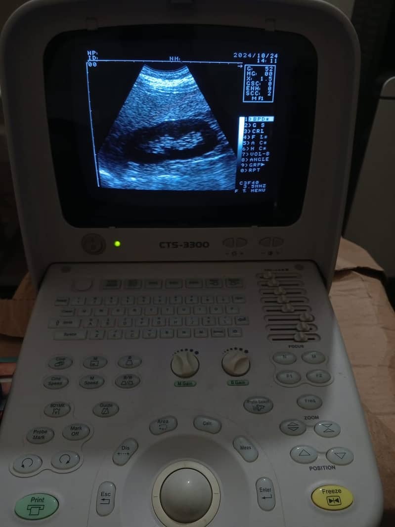 portable ultrasound machine / brand new ultrasound machine stock 15