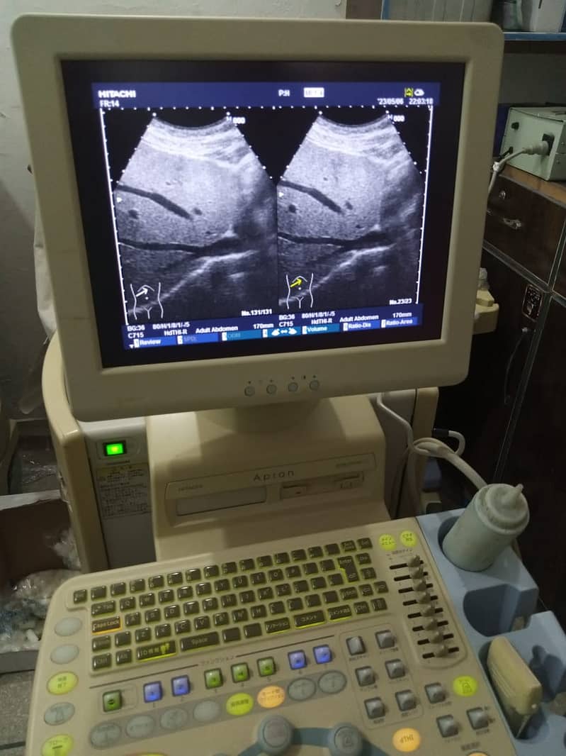 PORTABLE ULTRASOUND MACHINE / COLOR DOPPLER / REPAIRING LAB 6