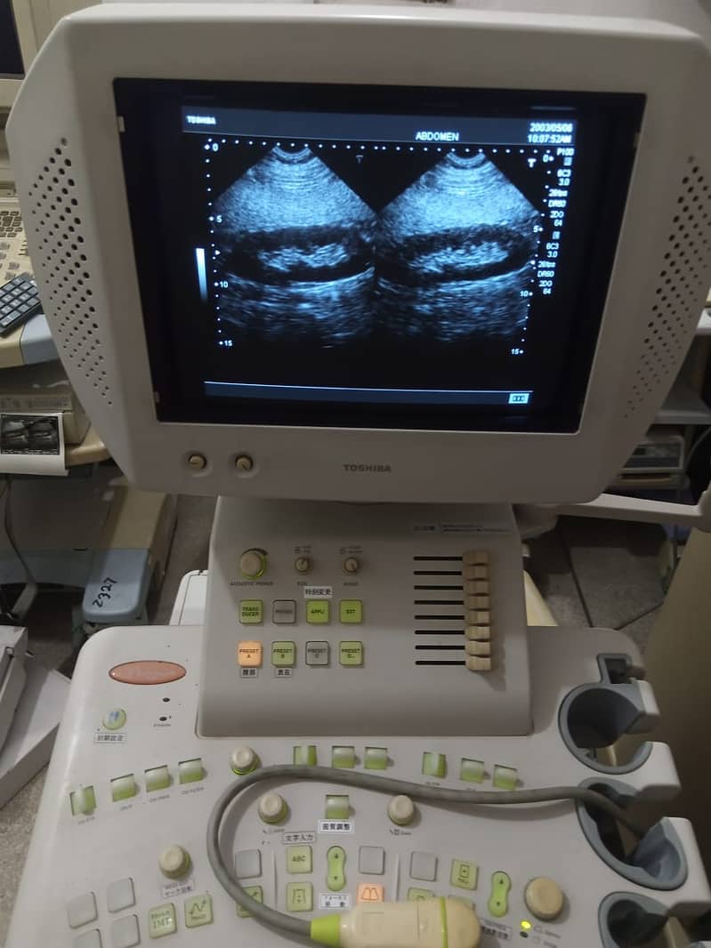 PORTABLE ULTRASOUND MACHINE / COLOR DOPPLER / REPAIRING LAB 12