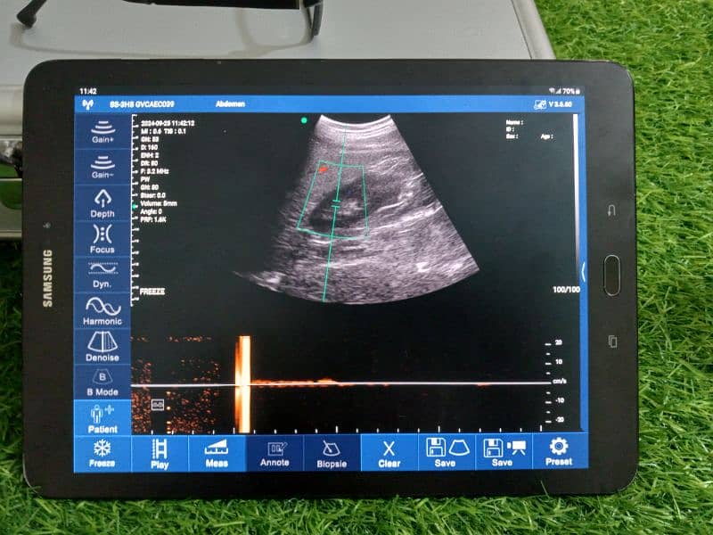 Ultrasound Color Doppler Wireless Probe 3