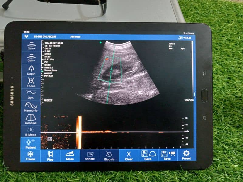 Ultrasound Color Doppler Wireless Probe 4