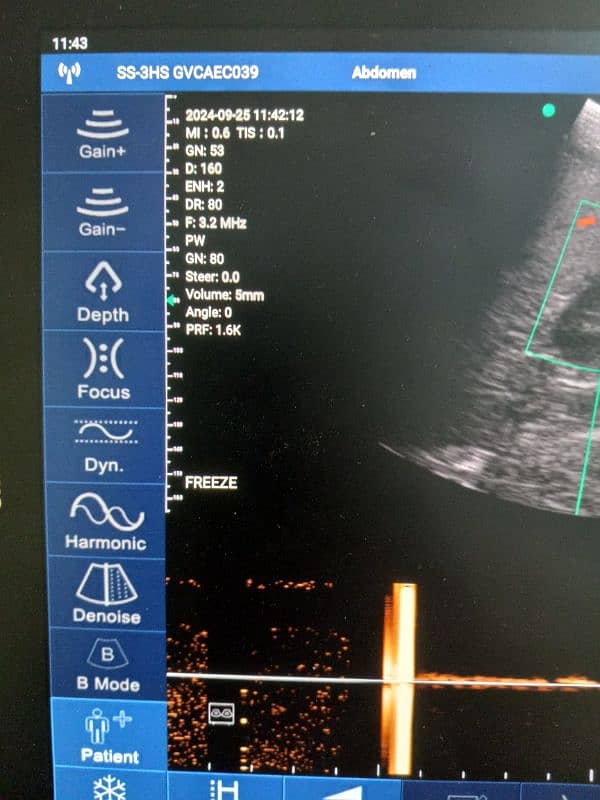 Ultrasound Color Doppler Wireless Probe 9