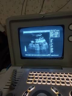 Used ultrasound machine