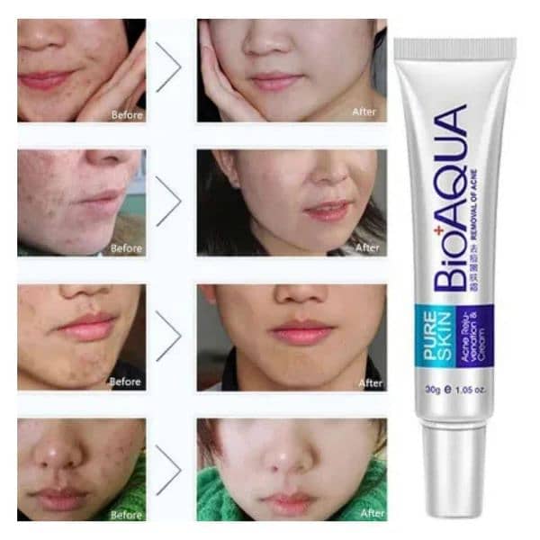 Acne Scar Removal face cream with guarantee 3