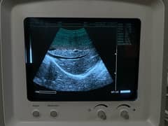 Ultrasound