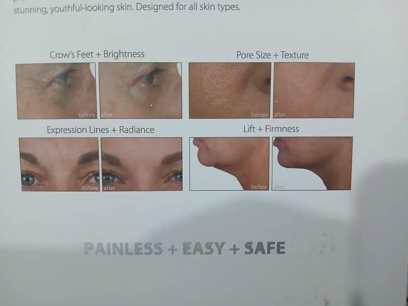 Skin Enhancement System 0