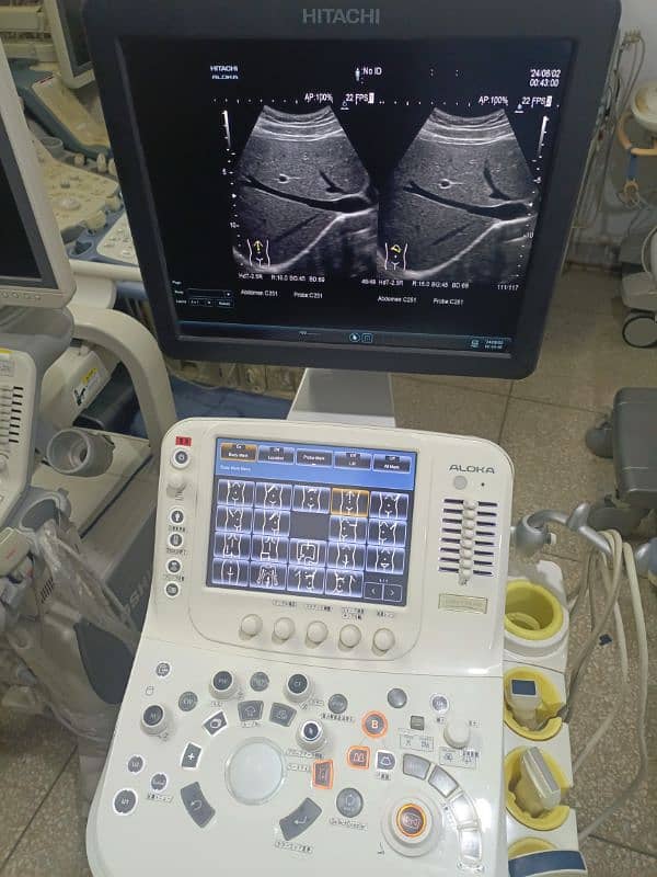 Ultrasound Machines 8