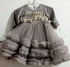 baby frock