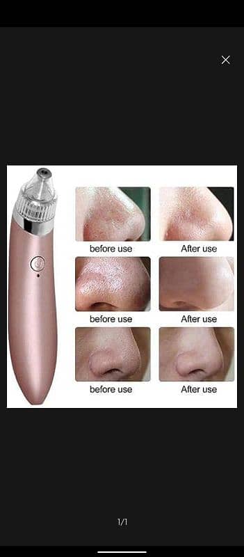 Portable electric blackheads suction tool, JB-8620 2