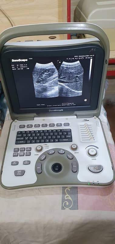 Ultrasound Machines Apollo-7,Toshiba Justvision400,SonoScape A5 &DUS60 2