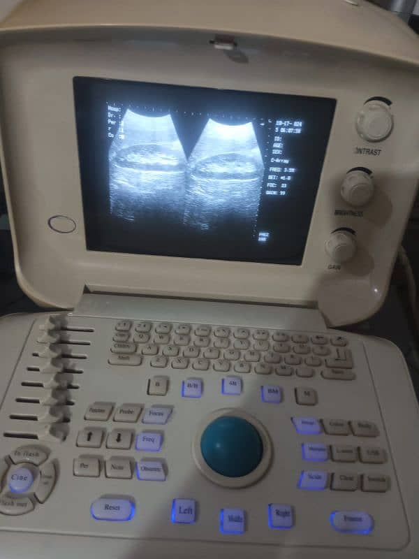 Ultrasound Machine 1