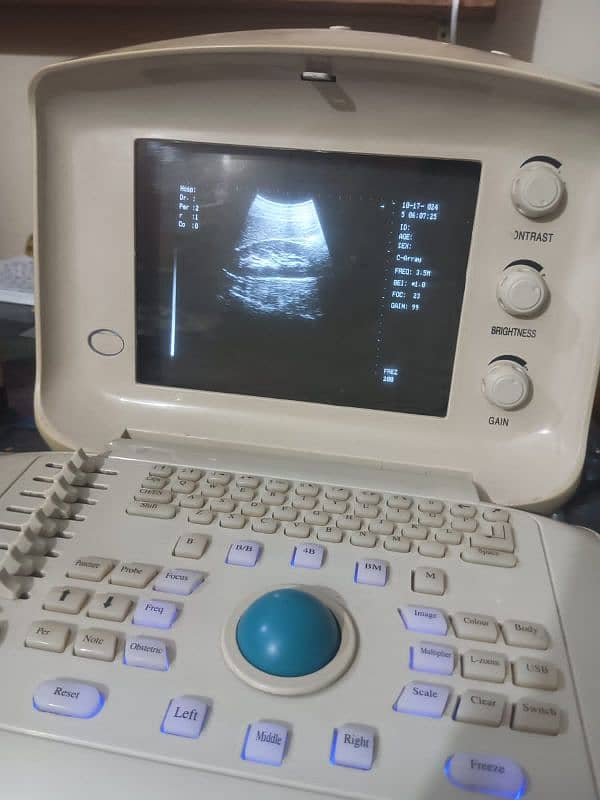 Ultrasound Machine 2