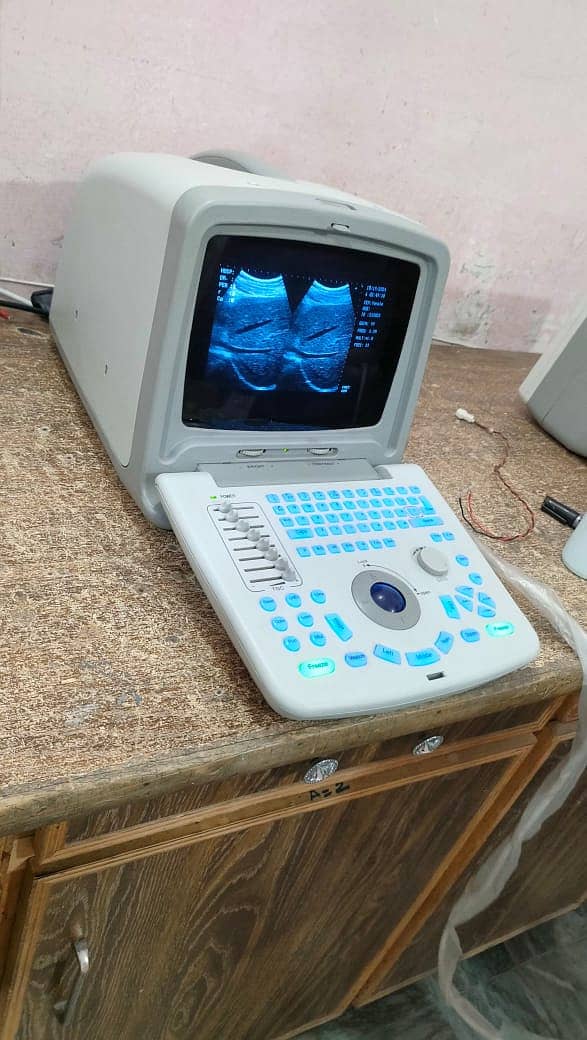 Used Chinese ultrasound machine (with or without battery backup) 1