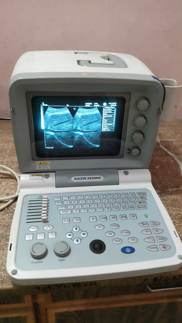 Used Chinese ultrasound machine (with or without battery backup) 2