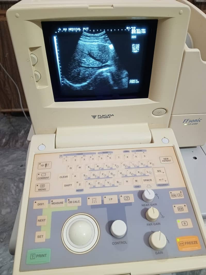 Used Chinese ultrasound machine (with or without battery backup) 4