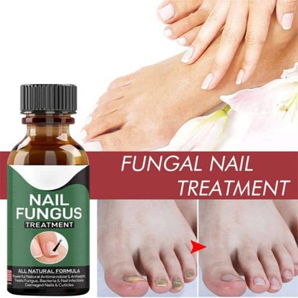 Fast Nail Fungal Treatments Nail Repair Essences Serum 0