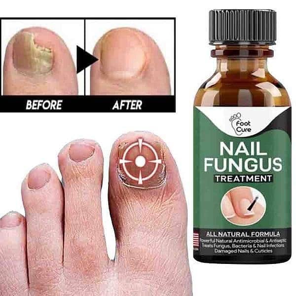 Fast Nail Fungal Treatments Nail Repair Essences Serum 1