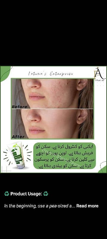 Face Wash | organic Acne Face Wash 3