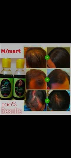 Hair Oil (100% Home Made)