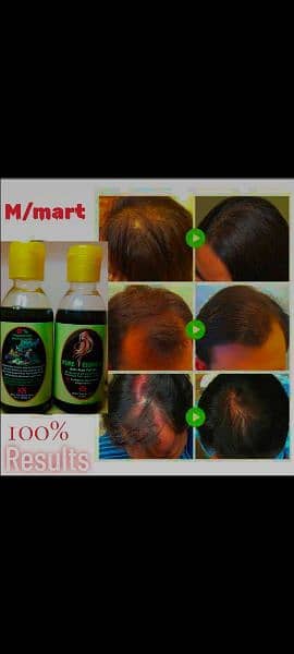 Hair Oil (100% Home Made) 0