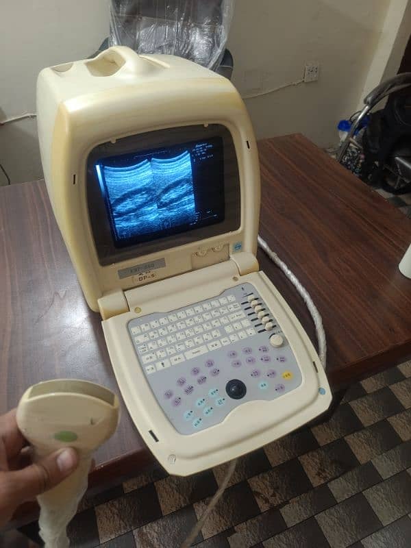 Japanese & China Ultrasound Machine's 4