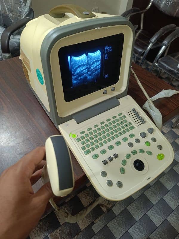 Japanese & China Ultrasound Machine's 11