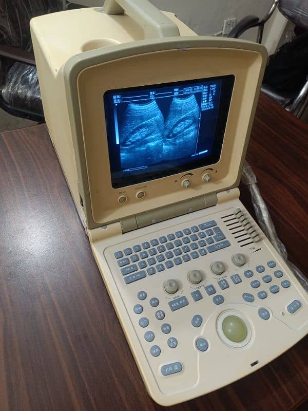 Japanese & China Ultrasound Machine's 17