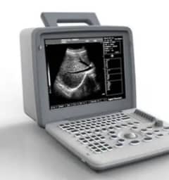 Digital Portable Ultrasound Scanner Apollo 7