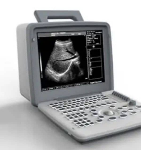 Digital Portable Ultrasound Scanner Apollo 7 0