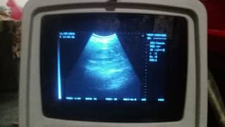 ultrasound with prob