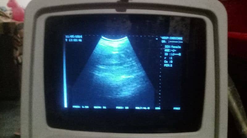 ultrasound with prob 0