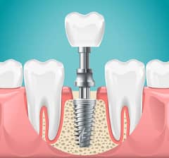 Male Dental Assistant required for clinic in Bahadurabad -