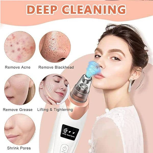 Electric Blackhead Remover (03195489309) /Free delivery 2